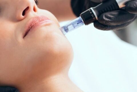 Dermapen