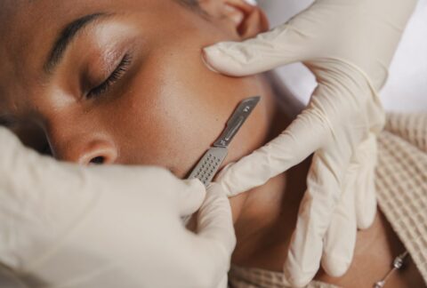 Dermaplaning + Dermapen