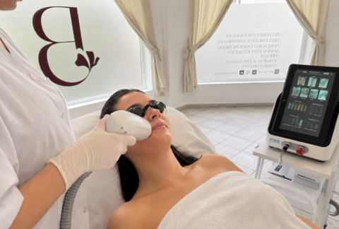 Depilación láser facial mujer